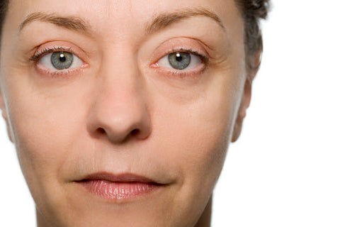 Under Eye Bags: Treatments and Tips